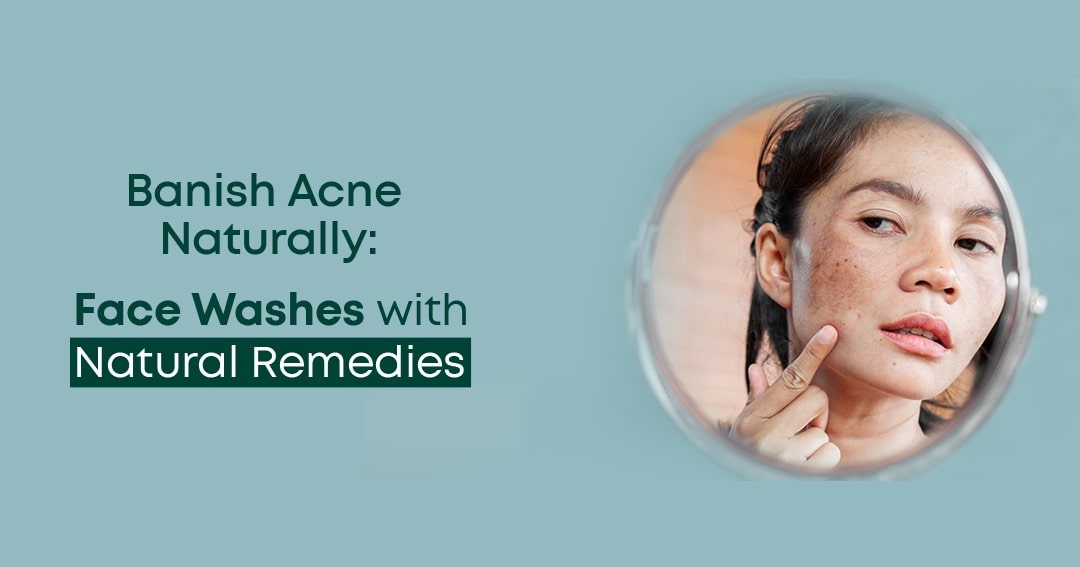 Banish Acne Naturally: Face Washes with Natural Remedies